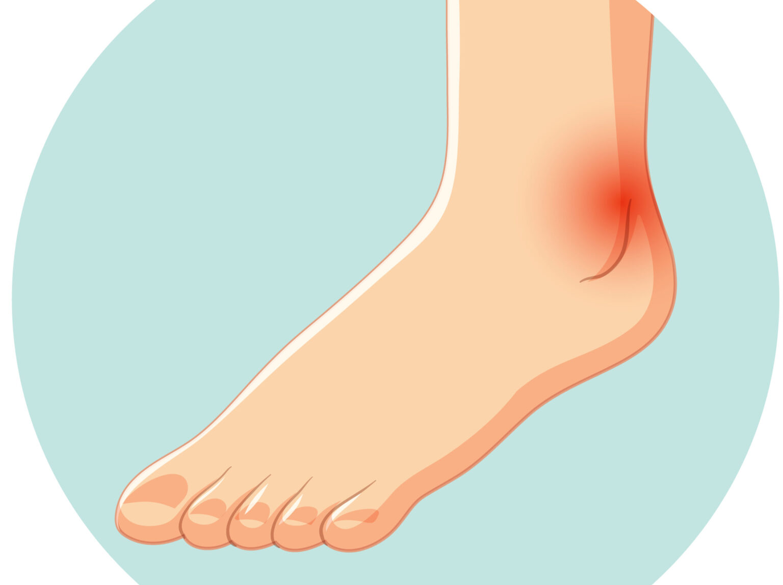 Homeopathic Medicines for Swollen Ankles - HOMOEO HEALING