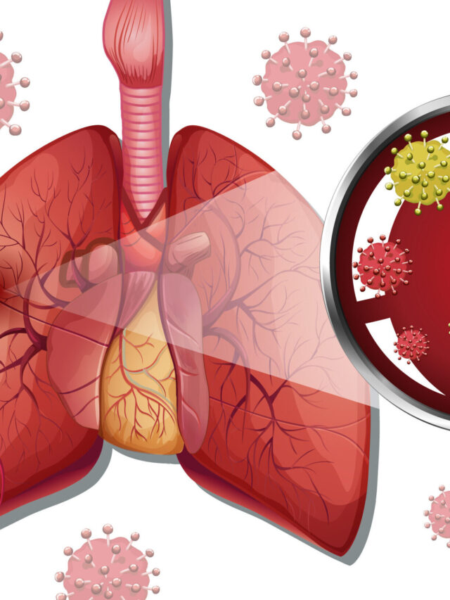 HOMEOPATHIC MEDICINE FOR PNEUMONIA