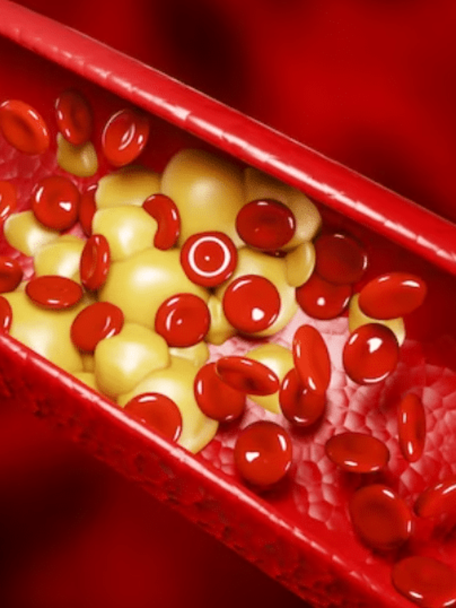 HOMEOPATHIC MEDICINE FOR HIGH CHOLESTEROL